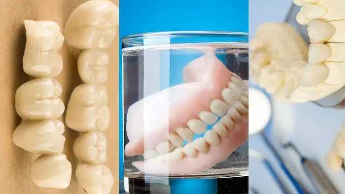 دندان چسبی با کیفیت و متریال ایده آل جایگزین ایمپلنت دندان 25415851154