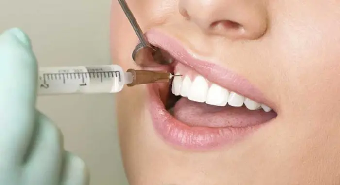 آپیکوکتومی دندان خانم جوان برای داشتن دندان های سالم 4541663526