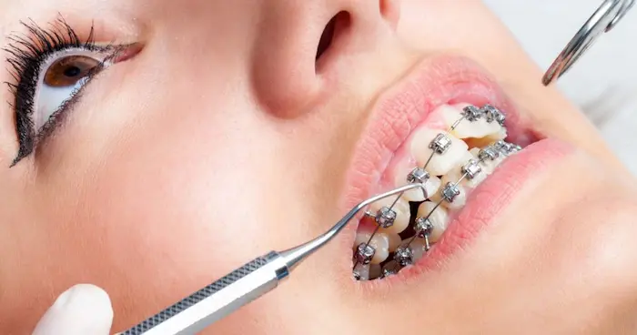 چک کردن ارتودنسی دندان توسط پزشک 621546412653521