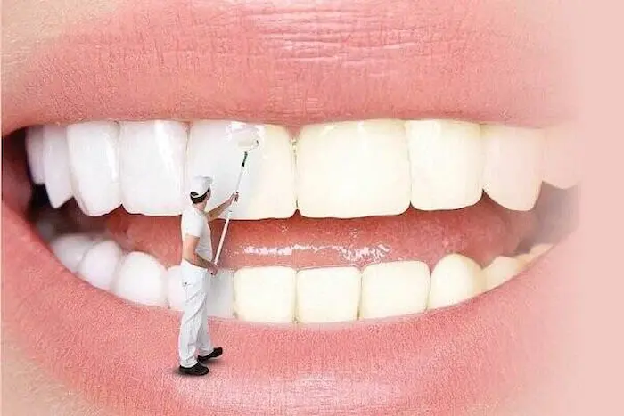پاکسازی دندان توسط پزشک 6546246541641