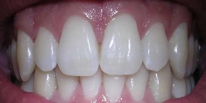 دندان های زیبا و سالم 46565465656