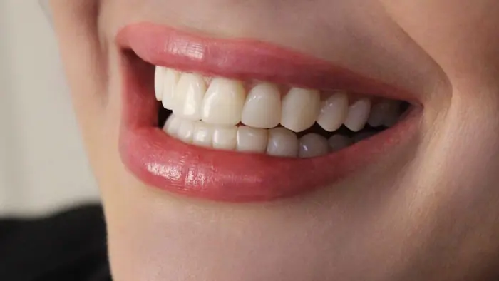 لبخند رضایت خانم از ترمیم دندان های بریج خود 658784516465