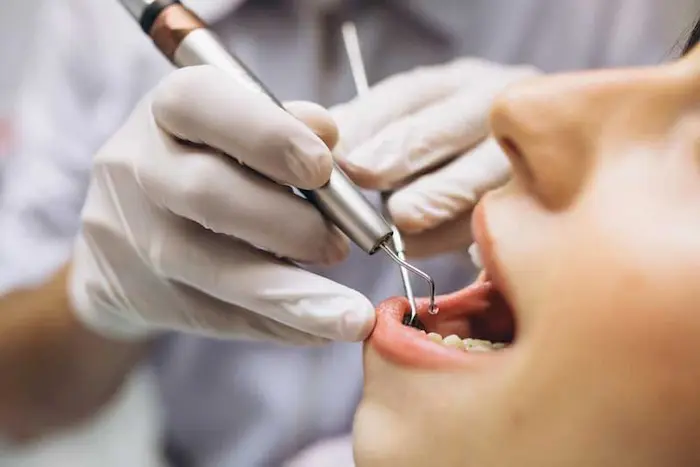 جراحی پزشک برای عصب کشی دندان بیمار 4687687454
