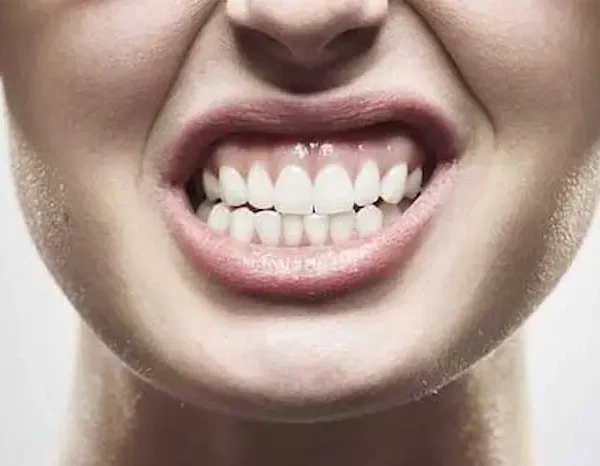 دندان قروچه در بزرگسالان 589478974