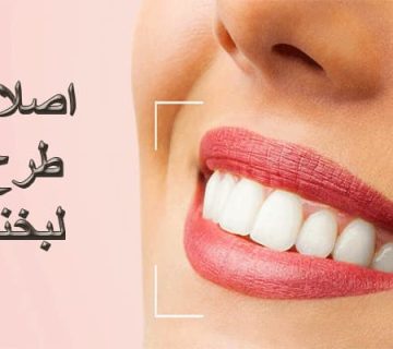 اصلاح طرح لبخند در گرگان دنتال 45684787