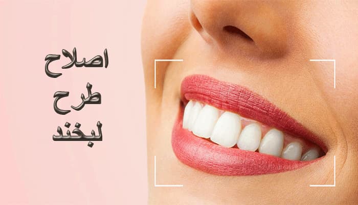 اصلاح طرح لبخند در گرگان دنتال 45684787