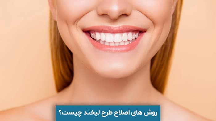 لبخند خانم با اصلاح طرح لبخند 496848