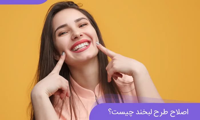 لبخند باوبهداز اصلاح طرح لبخند 45869768