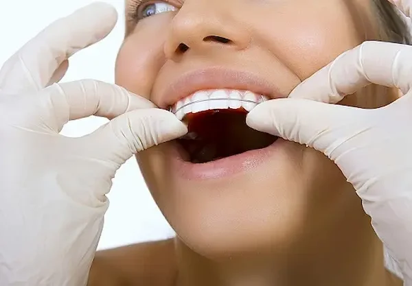 پزشک در حال تنظیم ارتودنسی متحرک در دهان بیمار 485484