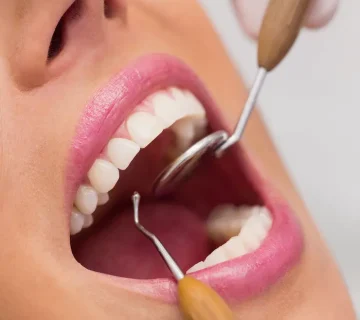 عصب کشی دندان های بیمار توسط دکتر 5151514