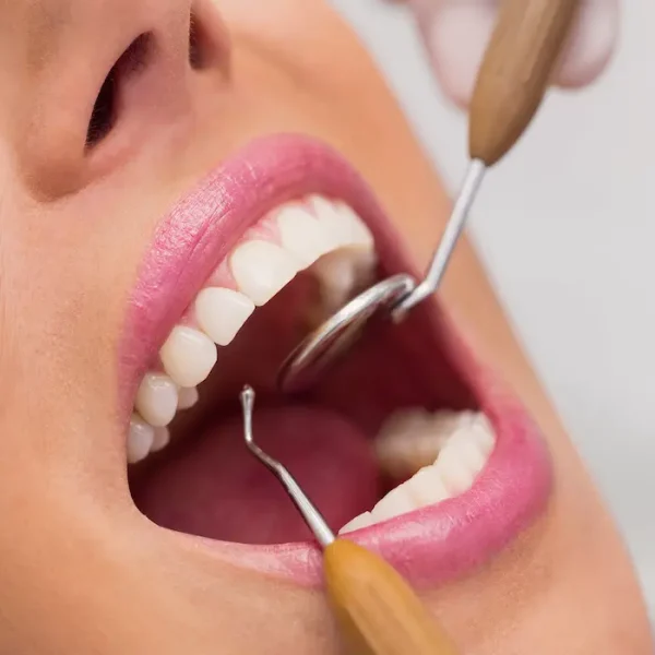 عصب کشی دندان های بیمار توسط دکتر 5151514