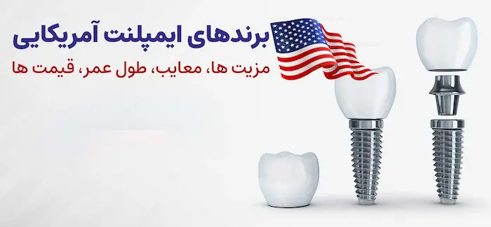 انواع برند ایمپلنت آمریکایی 47548375